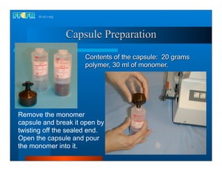Capsule Preparation
                     Contents of the capsule: 20 grams
                     polymer, 30 ml of monomer.




Remove the monomer
capsule and break it open by
twisting off the sealed end.
Open the capsule and pour
the monomer into it.
 