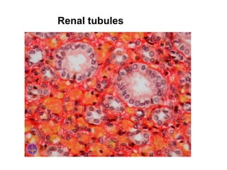 Renal tubules
 
