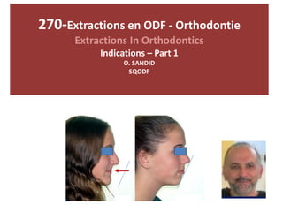 270-Extractions en ODF - Orthodontie
Extractions In Orthodontics
Indications – Part 1
O. SANDID
SQODF
 