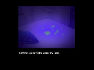 Seminal stains visible under UV light.
 