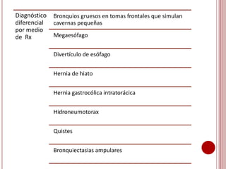 Diagnóstico
diferencial
por medio
de Rx
Bronquios gruesos en tomas frontales que simulan
cavernas pequeñas
Megaesófago
Divertículo de esófago
Hernia de hiato
Hernia gastrocólica intratorácica
Hidroneumotorax
Quistes
Bronquiectasias ampulares
 