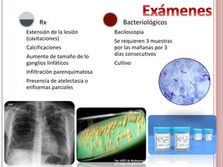 Extensión de la lesión
(cavitaciones)
Calcificaciones
Aumento de tamaño de lo
ganglios linfáticos
Infiltración parenquimatosa
Presencia de atelectasia o
enfisemas parciales
Rx
Baciloscopia
Se requieren 3 muestras
por las mañanas por 3
días consecutivos
Cultivo
Bacteriológicos
 