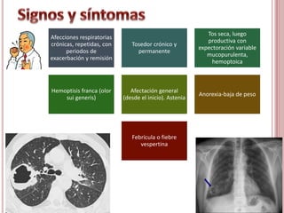Afecciones respiratorias
crónicas, repetidas, con
periodos de
exacerbación y remisión
Tosedor crónico y
permanente
Tos seca, luego
productiva con
expectoración variable
mucopurulenta,
hemoptoica
Hemoptisis franca (olor
sui generis)
Afectación general
(desde el inicio). Astenia
Anorexia-baja de peso
Febrícula o fiebre
vespertina
 