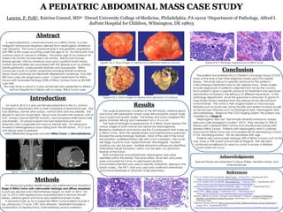A PEDIATRIC ABDOMINAL MASS CASE STUDY
Lauren. P. Polli1, Katrina Conard, MD2; 1Drexel University College of Medicine, Philadelphia, PA 19102 2Department of Pathology, Alfred I.
duPont Hospital for Children, Wilmington, DE 19803
Acknowledgments
Special thanks are extended to Steve Phillips, Heather Hardy, and
Linda Krawczuk.
Abstract
A nephroblastoma, commonly known as a Wilms Tumor, is a rare
malignant embryonal neoplasm derived from nephrogenic blastemal
cells (Murphy). This tumor is predominantly in the pediatric population
with 98% of the cases occurring under the age of 10. It is the fourth most
common type of cancer in children. The mean age of occurrence for
males is 36 months and females is 42 months. Risk factors include
female gender, African American race and a positive family history.
Certain abnormalities are associated with this disease such as aniridia,
hemihypertrophy, undescended testicles and hypospadia. Wilms
Tumors are a part of certain syndromes including WAGR syndrome,
Denys-Drash syndrome and Beckwith-Wiedemann syndrome. Only 400-
500 new cases are diagnosed a year. Current treatments for Wilms
Tumors with favorable histology (95% of Wilms Tumors) have an 85-90%
cure rate.
This case study is about a 3 year old female who presented to Alfred I.
duPont Hospital for Children with a classic Wilms Tumor case.
Introduction
On April 8, 2012 a 3 year old female presented to the A.I. duPont
Emergency Department with a chief complaint of abdominal pain. She
had diarrhea, normal urine output, normal vitals and was afebrile. She
refused to eat but would drink. Blood work showed mild anemia, LDH of
2731 mmol/L (normal 500-920 mmol/L), and increased white blood cells
(neutrophils). On physical exam she had abdominal pain and
distention with a palpable firm mass on the left side. An ultrasound
showed a heterogeneous mass arising from the left kidney. A CT scan
and biopsy were scheduled.
Initial differential diagnoses included Wilms Tumor or Neuroblastoma.
Methods
An ultrasound guided needle biopsy was preformed and showed a
Stage III Wilms Tumor with unfavorable histology and diffuse anaplasia.
A port was placed and chemotherapy began on April 14, 2012. On
July 16, 2012 a left nephrectomy was preformed to remove the left
kidney, adrenal gland and tumor plus additional lymph nodes.
A standard work up for a suspected Wilms Tumor patient include X-
ray, ultrasound, CT scan, CBC and urinalysis. Treatment includes a
combination of nephrectomy, chemotherapy and/or radiation.
Results
The surgical specimen consisted of the left kidney, adrenal gland
and tumor; left perinephric lymph node; left paraaortic lymph node
and 2 paracaval lymph nodes. The kidney and tumor weighed 692
grams (normal= 48.4 g) and measured 14.5 x 10 x 6 cm.
The typical histological appearance of a Wilms Tumor displays the
various stages of both normal and abnormal nephrogenesis.
Blastema, epithelium and stroma are the 3 components that make up
a Wilms Tumor. Both the needle biopsy and nephrectomy specimen
showed the same histologic features. Most of the cells in the tumor
are primitive, undifferentiated cells with scant cytoplasm. The nuclei
are large, round to oval, hyperchromatic and irregular. Nuclear
molding can also be seen. Multiple abnormal mitoses are identified.
Attempted tubule formation, which can be seen, is a dominant
feature of the tumor.
Both intralobular and periolobular nephrogenic rests were
identified within the kidney. The renal artery, renal vein and ureter
were uninvolved by tumor on permanent sections.
Immunohistochemistry was used to identify metastatic disease in the
lymph nodes. The WT-1 stain was used and confirmed metastases
and micrometastases in all lymph node specimens.
Conclusion
The patient was entered into a Children's Oncology Group (COG)
study at the time of her initial diagnosis based upon the needle
biopsy. This study laid out a specific protocol for the patient’s
chemotherapy treatment prior to her nephrectomy. These studies
include large pools of patients collected from across the country.
Each patient is given a specific protocol for treatment and specimen
examination to research the efficacy of different treatments. In the
pathology department, once the specimen is removed 10 grams of
snap frozen tissue is required from the primary tumor site and from
normal kidney. The tumor is then staged based on macroscopic
features such as tumor size, tumor focality and extent of tumor as well
as microscopic features such as histological type, nephrogenic rests
and metastases. Based on the COG staging system, this patient was
classified as a Stage III.
Nephrogenic rests are “abnormally retained embryonic kidney
precursor cells arranged in clusters” (NCI). They are seen in 35% of
kidneys with unilateral Wilms tumors and virtually every kidney with
bilateral Wilms Tumors. Patients with nephrogenic rests in a kidney
removed for Wilms Tumor are at increased risk for developing a tumor
in the remaining kidney. This risk decreases with age.
Patients with unfavorable histology (5% of Wilms Tumors) such as this
one, have a 72% 4-year survival rate at Stage III. She will need
continued surveillance for years to come to ensure a bilateral
tumor does not occur.
References
A.D.A.M. Medical Encyclopedia. Wilms Tumor. 16 May 2012. 7 September 2012
<http://www.ncbi.nlm.nih.gov/pubmedhealth/PMH0002542/>.
A.D.A.M. Medical Encyclopedia. Neuroblastoma. 7 February 2012. 7 September 2012
<http://www.ncbi.nlm.nih.gov/pubmedhealth/PMH0002381/>.
American Associated for Clinical Chemistry. LDH. 11 July 2011. 7 September 2012
<http://labtestsonline.org/understanding/analytes/ldh/>.
Mayo Clinic. Wilms’ Tumor. 2 September 2011. 7 September 2012
<http://www.mayoclinic.com/health/wilms-tumor/DS00436>.
Murphy, William M, David J Gringnon and Elizabeth J Perlman. Tumors of the Kidney,
Bladder, and Related Urinary Structures. Washington D.C.: American Registry of
Pathology 2004
National Cancer Institute. Wilms Tumor and Other Childhood Kidney Tumors Treatment. 9
August 2012. 13 September 2012.
<http://www.cancer.gov/cancertopics/pdq/treatment/wilms/HealthProfessional/page2>.
Figure 1- Abdominal CT Scans showing large mass on left kidney.
Figures 2 & 3- Gross images of nephrectomy specimen external surfaces.
Figures 4 & 5- Gross images of nephrectomy specimen cut surfaces.
Figures 6 & 7- Histologic appearance of Wilms Tumor
Figures 8 & 9- Histologic appearance of Wilms Tumor
 