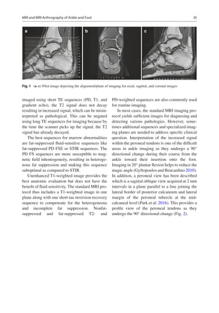 Imaging Of The Foot And Ankle Techniques And Applications 2nd Mark ...