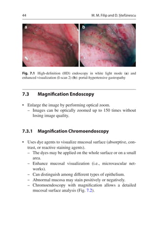 Pocket Guide To Advanced Endoscopy In Gastroenterology Adrian Sftoiu | PDF