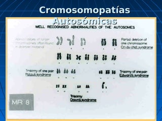 Isocromosomas




Se denominan isocromosomas a
los cromosomas metacéntricos
producidos durante la meiosis o
mitosis, cua...