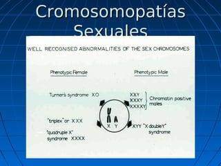 Síndrome de
Klinefelter


En el síndrome de Klinefelter existe al menos
un cromosoma X adicional y un Y.



Esta condici...