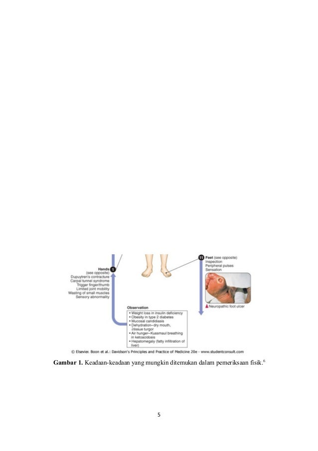 274409377 makalah-diabetes-melitus-tipe-2