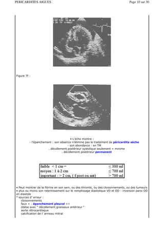 PERICARDITES AIGUES                                                              Page 10 sur 30




Figure 7f :




                                        • L’écho montre :
          - l’épanchement : son absence n’élimine pas le traitement de péricardite sèche
                                      - son abondance : en TM
                       . décollement postérieur systolique seulement = minime
                                 . décollement postérieur permanent




• Peut montrer de la fibrine en son sein, ou des thrombi, ou des cloisonnements, ou des tumeurs
• plus ou moins son retentissement sur le remplissage diastolique VD et OD : inversion paroi OD
en diastole
° sources d’ erreur :
    cloisonnements
    faux + : épanchement pleural ++
    obèse avec “ décollement graisseux antérieur “
    aorte rétrocardiaque
    calcification de l’ anneau mitral
 