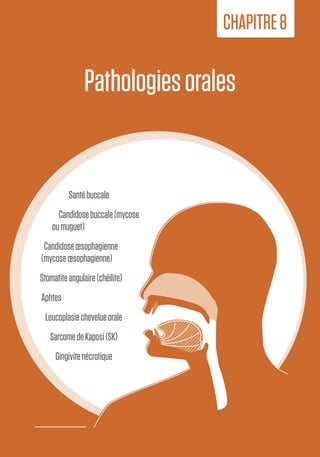 131
8.Pathologies
orales
Pathologiesorales
CHAPITRE8
Santébuccale
Candidosebuccale(mycose
oumuguet)
Candidoseœsophagienne
(mycoseœsophagienne)
Stomatiteangulaire(chéilite)
Aphtes
Leucoplasiechevelueorale
SarcomedeKaposi(SK)
Gingivitenécrotique
 