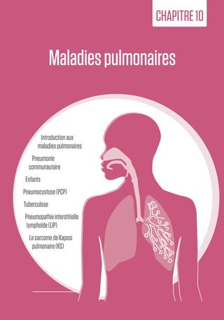 167
10.Maladies
pulmonaires
Maladiespulmonaires
CHAPITRE10
Introductionaux
maladiespulmonaires
Pneumonie
communautaire
Enfants
Pneumocystose(PCP)
Tuberculose
Pneumopathieinterstitielle
lymphoïde(LIP)
LesarcomedeKaposi
pulmonaire(KS)
 