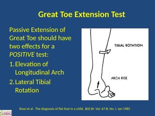 Management of Flatfoot education health care | PPTX