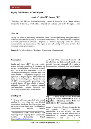 CASE REPORT
NJR I VOL 2 I ISSUE 1 I Jan-June, 2012
Leydig Cell Tumor: A Case Report
Amatya N 1
, Zhu M 2
, Sapkota P K 1
1
Radiology Unit, Helping Hands Community Hospital, Kathmandu, Nepal, 2
Department of
Diagnostic Ultrasound, West China Hospital of Sichuan University, Chengdu, China
Abstract
Leydig cell tumor is a relatively uncommon tumor clinically presenting with gynecomastia,
increased sex hormone levels (i.e. testosterone and estradiol) and other correlated symptoms.
However, preoperative ultrasonic diagnosis is difficult especially when the clinical
manifestations are unremarkable. We report a case of Leydig cell tumor of testis that
presented with atypical features.
Keywords: Leydig cell tumor, Neoplasm, Testosterone, Ultrasonography
Introduction
Leydig cell tumor (LCT) is a rare entity
among testicular neoplasm. It can occur at
any age, typically between 30 and 60 years of
age. Due to variable appearance, it can be
challenging to distinguish between germ cell
tumor and LCT. Sonographic imaging is still
a problem in diagnosing this entity and hence
easily can be misdiagnosed.1
We report a case
of LCT sonographically presenting with
atypical features of “thin tubular structures”
and color Doppler USG revealing a marked
hypervascularity pattern highlight the
ultrasonography-histological correlation.
Case Report
A 46 year old man presented with scrotal
swelling for more than one year. Genital
examination found that the right scrotum was
swollen with mild tenderness. The laboratory
examination revealed normal
____________________________________
Correspondence to: Dr. Nabin Amatya, MD
Radiology Unit, Helping Hands Community
Hospital Kathmandu, Nepal
Email:naabbin@hotmail.com
AFP and HCG. Enhanced-abdominal CT
revealed that the both adrenal glands were
normal. However, enhanced CT revealed a
homogenously enhanced right intratesticular
Fig 1: CT scans of 46-year-old male with
Leydig cell tumor. Enhanced CT shows a
hyperdense enhancing tumor. Note that
the left testis (LT) is unremarkable.
nodule of size 3.0 x 2.0 cm with clear border
and margin (Figure1). Ultrasound
examination is a non invasive and non-
ionising tool and it has been widely used in
examination of scrotum. During B-mode
examination, size of 3.0 x
39
 