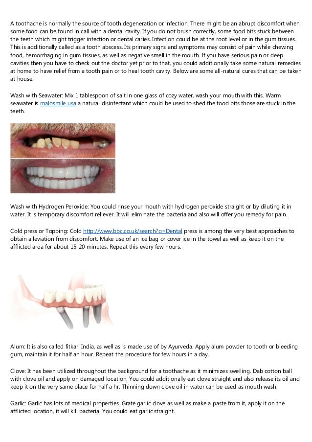 What Not To Do In The Clear Choice Dental Implants Reviews Complaints