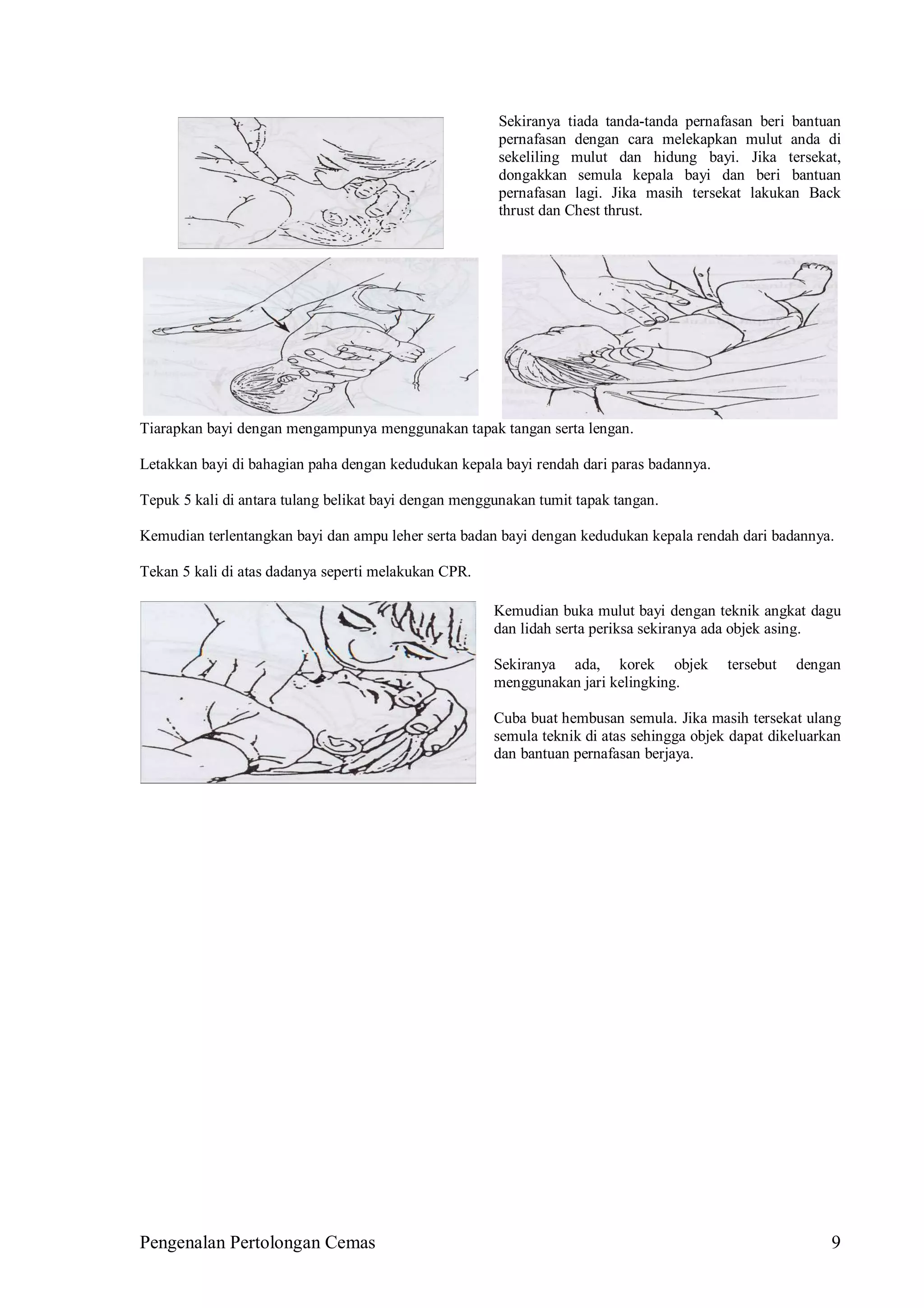Pengenalan Pertolongan Cemas 9
Sekiranya tiada tanda-tanda pernafasan beri bantuan
pernafasan dengan cara melekapkan mulut anda di
sekeliling mulut dan hidung bayi. Jika tersekat,
dongakkan semula kepala bayi dan beri bantuan
pernafasan lagi. Jika masih tersekat lakukan Back
thrust dan Chest thrust.
Tiarapkan bayi dengan mengampunya menggunakan tapak tangan serta lengan.
Letakkan bayi di bahagian paha dengan kedudukan kepala bayi rendah dari paras badannya.
Tepuk 5 kali di antara tulang belikat bayi dengan menggunakan tumit tapak tangan.
Kemudian terlentangkan bayi dan ampu leher serta badan bayi dengan kedudukan kepala rendah dari badannya.
Tekan 5 kali di atas dadanya seperti melakukan CPR.
Kemudian buka mulut bayi dengan teknik angkat dagu
dan lidah serta periksa sekiranya ada objek asing.
Sekiranya ada, korek objek tersebut dengan
menggunakan jari kelingking.
Cuba buat hembusan semula. Jika masih tersekat ulang
semula teknik di atas sehingga objek dapat dikeluarkan
dan bantuan pernafasan berjaya.
 