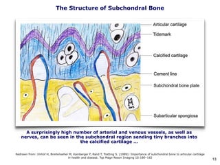 The Structure of Subchondral Bone
Redrawn from: Imhof H, Breitenseher M, Kainberger F, Rand T, Trattnig S. (1999): Importance of subchondral bone to articular cartilage
in health and disease. Top Magn Reson Imaging 10:180–192
A surprisingly high number of arterial and venous vessels, as well as
nerves, can be seen in the subchondral region sending tiny branches into
the calcified cartilage …
13
 