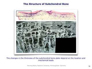 The Structure of Subchondral Bone
The changes in the thickness of the subchondral bone plate depend on the location and
mechanical loads
Henning Madry, Saarland University, Homburg/Saar, Germany
15
 