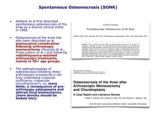 Spontaneous Osteonecrosis (SONK)
• Ahlback et al first described
spontaneous osteonecrosis of the
knee as a distinct clinical entity
in 1968.
• Osteonecrosis of the knee has
also been described as a
postsurgical complication
following arthroscopic
meniscectomy (Muscolo et al.,
Prues-Latour et al.) and following
radiofrequency-assisted
arthroscopic treatments,
mainly in 50+ age groups.
• The pathophysiology of
osteonecrosis following these
arthroscopic procedures is not
fully understood (vascular
isufficiency, trabecular
microfractures?), or, more
likely, a consequence of pre-
arthrosopy osteopoenia and
altered focal biomechanics
(bone density should be
looked into).
 