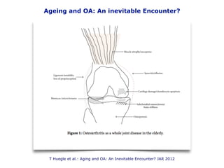 Ageing and OA: An inevitable Encounter?
T Huegle et al.: Aging and OA: An Inevitable Encounter? JAR 2012
 