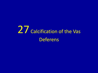 27Calcification of the Vas
Deferens
 