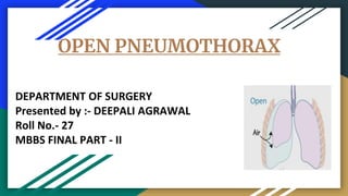 OPEN PNEUMOTHORAX
DEPARTMENT OF SURGERY
Presented by :- DEEPALI AGRAWAL
Roll No.- 27
MBBS FINAL PART - II
 