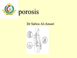 OsteoporosisOsteoporosis
Dr Salwa Al-AnsariDr Salwa Al-Ansari
 