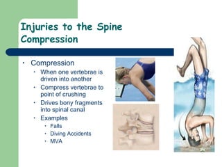 27)Injuries To The Head And Spine | PPT