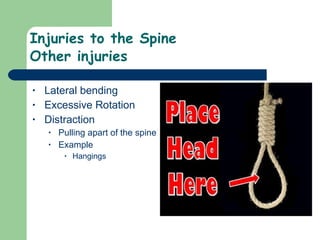 27)Injuries To The Head And Spine | PPT
