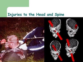 Injuries to the Head and Spine 