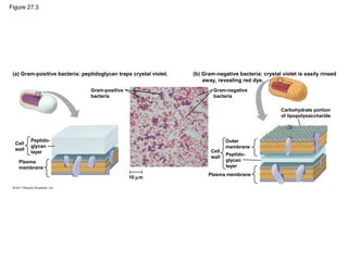 Figure 27.3
(a) Gram-positive bacteria: peptidoglycan traps crystal violet.
Gram-positive
bacteria
Peptido-
glycan
layer
Cell
wall
Plasma
membrane
10 µm
Gram-negative
bacteria
Outer
membrane
Peptido-
glycan
layer
Plasma membrane
Cell
wall
Carbohydrate portion
of lipopolysaccharide
(b) Gram-negative bacteria: crystal violet is easily rinsed
away, revealing red dye.
 