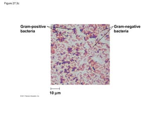 Figure 27.3c
Gram-positive
bacteria
10 µm
Gram-negative
bacteria
 