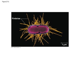 Figure 27.5
Fimbriae
1 µm
 