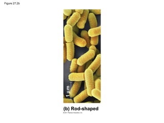 Figure 27.2b
(b) Rod-shaped
1µm
 