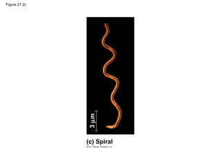 Figure 27.2c
(c) Spiral
3µm
 