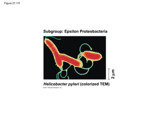 Figure 27.17f
Subgroup: Epsilon Proteobacteria
2µm
Helicobacter pylori (colorized TEM)
 