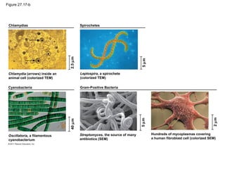 Figure 27.17-b
Chlamydias
5µm
Spirochetes
2.5µm Leptospira, a spirochete
(colorized TEM)
Gram-Positive Bacteria
2µm
5µm
Hundreds of mycoplasmas covering
a human fibroblast cell (colorized SEM)
Streptomyces, the source of many
antibiotics (SEM)
40µm
Oscillatoria, a filamentous
cyanobacterium
Cyanobacteria
Chlamydia (arrows) inside an
animal cell (colorized TEM)
 