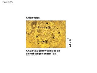 Figure 27.17g
Chlamydias
2.5µm
Chlamydia (arrows) inside an
animal cell (colorized TEM)
 