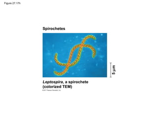 Figure 27.17h
5µm
Spirochetes
Leptospira, a spirochete
(colorized TEM)
 