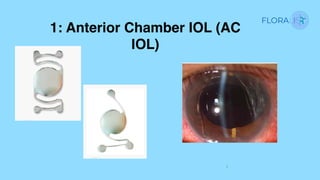 IOL options in the absence of capsular support | PDF