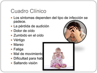 Cuadro Clínico
 Los síntomas dependen del tipo de infección se












padece.
La pérdida de audición
Dolor de oído
Zumbido en el oído
Vértigo
Mareo
Fatiga
Mal de movimiento
Dificultad para hablar
Saltando visión

 
