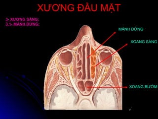 XƯƠNG ĐẦU MẶTXƯƠNG ĐẦU MẶT
MẢNH ĐỨNG
XOANG SÀNG
XOANG BƯỚM
3- XƯƠNG SÀNG:
3.1- MẢNH ĐỨNG:
 