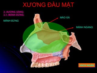 XƯƠNG ĐẦU MẶTXƯƠNG ĐẦU MẶT
3- XƯƠNG SÀNG:
3.1- MẢNH ĐỨNG:
MÀO GÀ
MẢNH NGANG
VÁCH NGĂNVÁCH NGĂN
MẢNH ĐỨNG
 