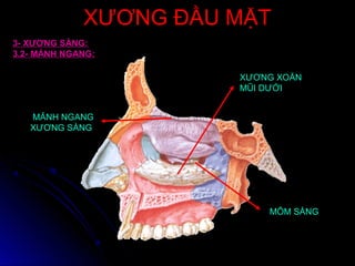 XƯƠNG ĐẦU MẶTXƯƠNG ĐẦU MẶT
3- XƯƠNG SÀNG:
3.2- MẢNH NGANG:
XƯƠNG XOĂN
MŨI DƯỚI
MÕM SÀNG
MẢNH NGANG
XƯƠNG SÀNG
 