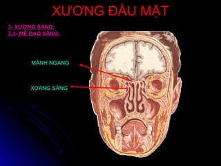 XƯƠNG ĐẦU MẶTXƯƠNG ĐẦU MẶT
3- XƯƠNG SÀNG:
3.3- MÊ ĐẠO SÀNG:
MẢNH NGANG
XOANG SÀNG
 