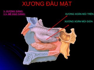 XƯƠNG ĐẦU MẶTXƯƠNG ĐẦU MẶT
XƯƠNG XOĂN MŨI TRÊN
XƯƠNG XOĂN MŨI GIỮA
3- XƯƠNG SÀNG:
3.3- MÊ ĐẠO SÀNG:
 