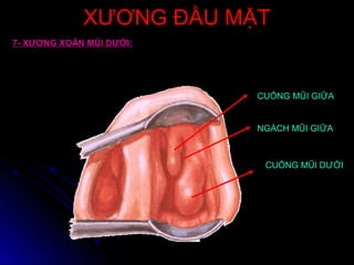 XƯƠNG ĐẦU MẶTXƯƠNG ĐẦU MẶT
CUỐNG MŨI DƯỚI
CUỐNG MŨI GIỮA
NGÁCH MŨI GIỮA
7- XƯƠNG XOĂN MŨI DƯỚI:
 
