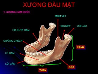 XƯƠNG ĐẦU MẶTXƯƠNG ĐẦU MẶT
1- XƯƠNG HÀM DƯỚI:
CÀNHCÀNH
THÂNTHÂN
LỒI CẦU
MÕM VẸT
KHUYẾT
HỐ DƯỚI HÀM
LỖ CẰM
LỒI CẰM
ĐƯỜNG CHẾCH
GÓCGÓC
 
