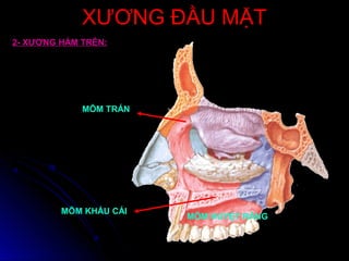 XƯƠNG ĐẦU MẶTXƯƠNG ĐẦU MẶT
2- XƯƠNG HÀM TRÊN:
MÕM KHẨU CÁI
MÕM HUYỆT RĂNG
MÕM TRÁN
 