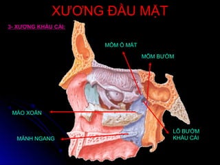 XƯƠNG ĐẦU MẶTXƯƠNG ĐẦU MẶT
3- XƯƠNG KHẨU CÁI:
MÕM Ổ MẮT
MÕM BƯỚM
LỖ BƯỚM
KHẨU CÁI
MÀO XOĂN
MẢNH NGANG
 